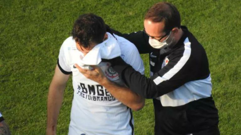 VIDEO: Mauro Boselli sufrió fractura en el rostro durante partido de Corinthians