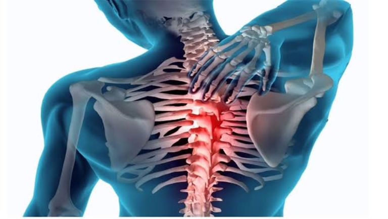 Las secuelas por Covid-19 pueden causar dolores de espalda