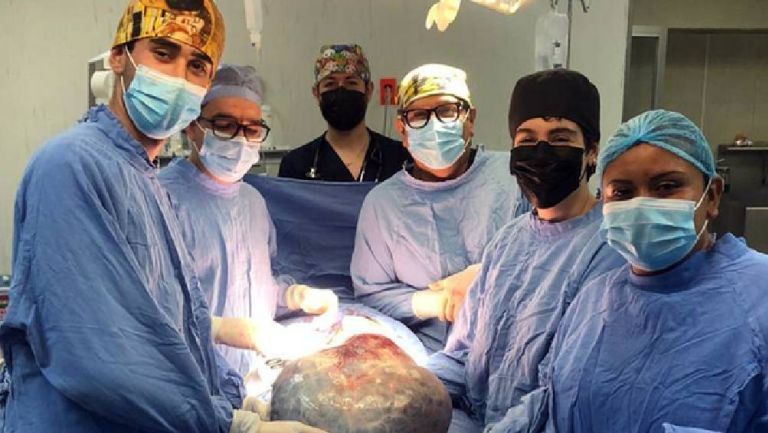 Médicos del IMSS retiran tumor de 21 kilos a señora de 60 años